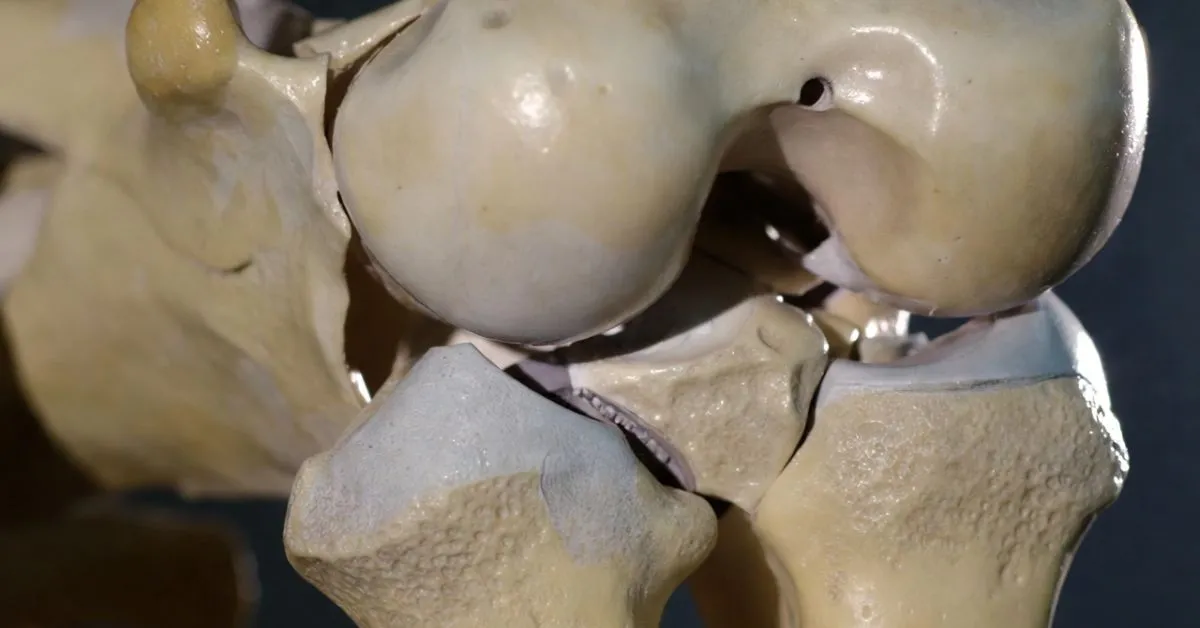 Coronoid Fossa (Fossa Coronoidea)